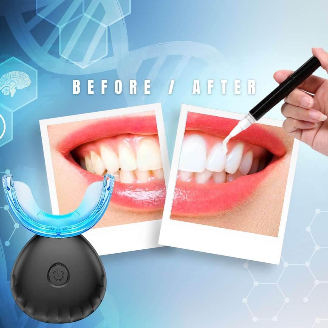 Teeth Whitening Gel Refill (For LED Teeth Kit) - Pro Charcoal
